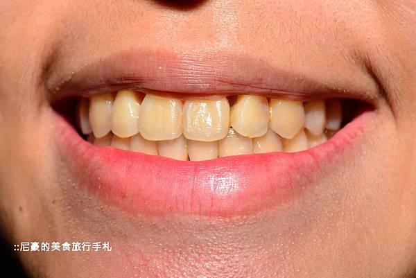 [生活綜合] 萊思Li-ZEY 鑽石亮白美齒儀 日本超人氣商品 牙齒清潔亮白好幫手 @尼豪的美食旅行手札